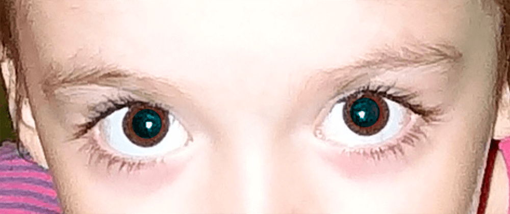 Результат удаления красных глаз на фото в Фотошопе