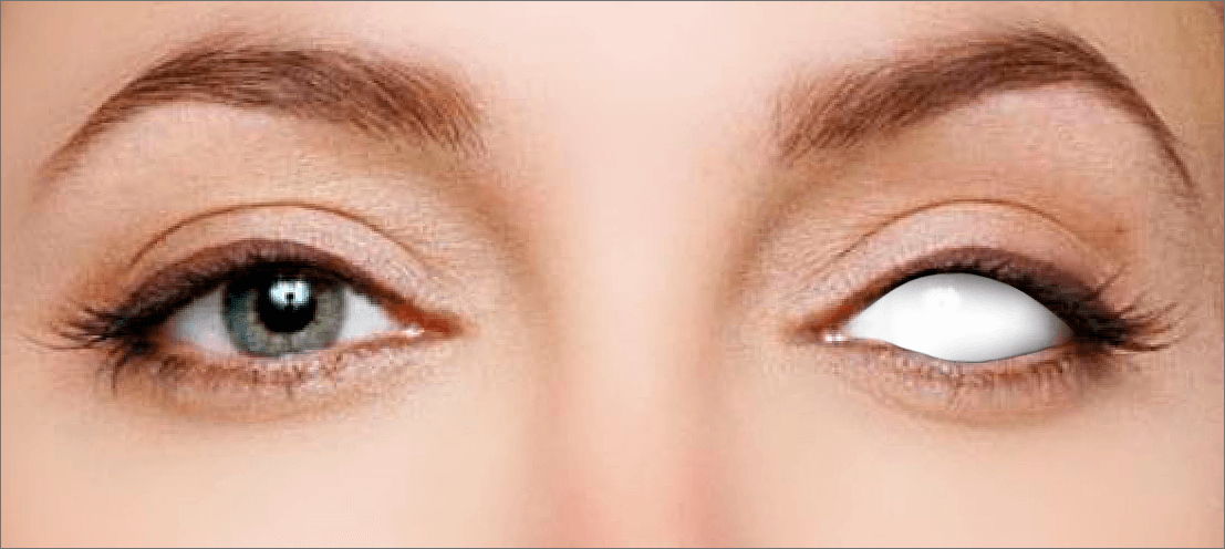 Как ретушировать глаза с помощью Lightroom